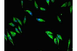 Immunofluorescent analysis of Hela cells using ABIN7159746 at dilution of 1:100 and Alexa Fluor 488-congugated AffiniPure Goat Anti-Rabbit IgG(H+L)