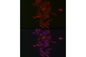 Immunofluorescence analysis of PC-12 cells using NRP2 Rabbit pAb (ABIN3016282, ABIN3016283, ABIN3016284, ABIN1681113 and ABIN6219689) at dilution of 1:50 (40x lens).