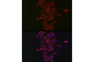 Immunofluorescence analysis of PC-12 cells using NRP2 Rabbit pAb (ABIN3016282, ABIN3016283, ABIN3016284, ABIN1681113 and ABIN6219689) at dilution of 1:50 (40x lens). (NRP2 anticorps  (AA 150-420))