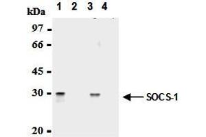 Immunoprecipitation of SOCS-1 from mouse splenocytes and mouse thymocytes with AM26561AF-N (1,3) or mouse IgG1 (2,4). (SOCS1 anticorps  (AA 2-78))