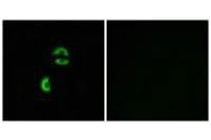 Immunofluorescence analysis of A549 cells, using LDLRAD3 antibody. (LDLRAD3 anticorps)