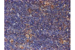 Image no. 2 for anti-Proteasome (Prosome, Macropain) 26S Subunit, Non-ATPase, 2 (PSMD2) antibody (ABIN1500479)