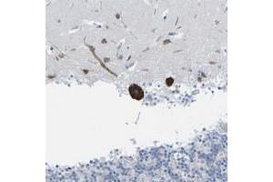 Immunohistochemical staining of human cerebellum with PDZK1IP1 polyclonal antibody  shows strong cytoplasmic positivity in purkinje cells. (PDZK1 Interacting Protein 1 (PDZK1IP1) anticorps)