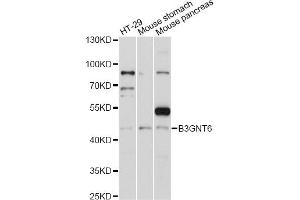Western blot analysis of extracts of various cell lines, using B3GNT6 antibody (ABIN6292802) at 1:1000 dilution. (B3GNT6 anticorps)