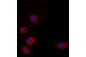 Immunofluorescent analysis of BRP44L staining in A549 cells. (BRP44L anticorps  (N-Term))
