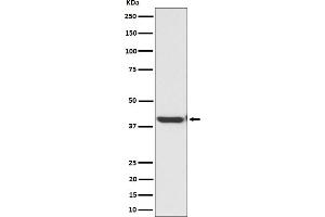 Western blot analysis of ENDOGL1 / ENGL expression in HepG2 cell lysate.