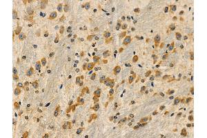 ABIN6258427 and ABIN6275063 at 1/100 staining Mouse brain tissue by IHC-P.