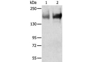 Western Blot analysis of Human jejunoileum and ileum tissue using TRPM6 Polyclonal Antibody at dilution of 1:200 (TRPM6 anticorps)