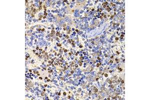 Immunohistochemistry of paraffin-embedded rat spleen using UBASH3B antibody (ABIN5974296) at dilution of 1/100 (40x lens). (UBASH3B anticorps)