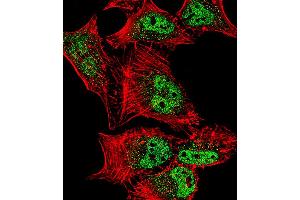 Fluorescent confocal image of Hela cell stained with MEF2C Antibody (S387). (MEF2C anticorps  (AA 365-394))