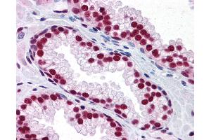 Anti-SAFB antibody IHC of human prostate. (SAFB anticorps  (AA 111-201))