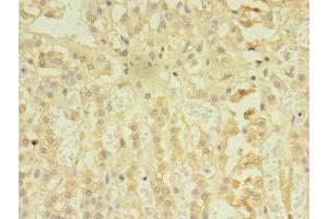 Immunohistochemistry of paraffin-embedded human adrenal gland tissue using ABIN7167480 at dilution of 1:100 (RIPK3 anticorps  (AA 1-518))