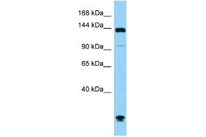 Host: Rabbit Target Name: Plcb1 Sample Type: Mouse Testis lysates Antibody Dilution: 1. (Phospholipase C beta 1 anticorps  (C-Term))
