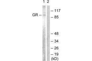 Western blot analysis of extracts from Jurkat cells, treated with EGF (200 ng/mL, 15 mins), using GR (Ab-226) antibody. (Glucocorticoid Receptor anticorps  (Ser226, Ser234, Ser246))