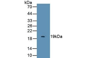 Detection of Recombinant ESM1, Human using Monoclonal Antibody to Endothelial Cell Specific Molecule 1 (ESM1) (ESM1 anticorps  (AA 20-184))