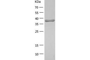 Peroxiredoxin 4 (PRDX4) (AA 38-123) protein (His-IF2DI Tag)