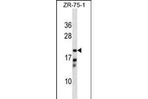 CBR4 Antibody (C-term) (ABIN1536794 and ABIN2849112) western blot analysis in ZR-75-1 cell line lysates (35 μg/lane).