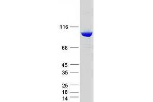 Validation with Western Blot