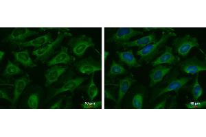 ICC/IF Image C9orf98 antibody [N3C3] detects C9orf98 protein at cytoplasm by immunofluorescent analysis.