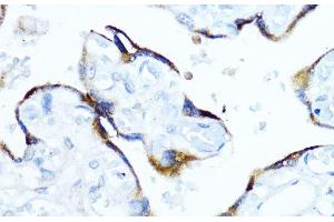 Immunohistochemistry of paraffin-embedded Human placenta using Aromatase Polyclonal Antibody at dilution of 1:100 (40x lens). (Aromatase anticorps)