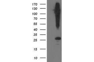 Western Blotting (WB) image for anti-Synaptosomal-Associated Protein, 25kDa (SNAP25) antibody (ABIN1501016) (SNAP25 anticorps)