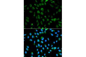 Immunofluorescence analysis of MCF-7 cells using PSMA3 antibody.
