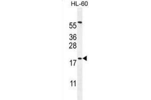 Western Blotting (WB) image for anti-Developmental Pluripotency Associated 5 (DPPA5) antibody (ABIN2996143) (DPPA5 anticorps)