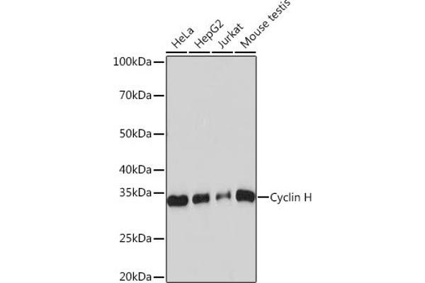 Cyclin H anticorps