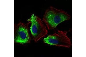 Immunofluorescence analysis of Hela cells using THY1 mouse mAb (green). (CD90 anticorps  (AA 17-132))