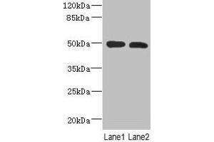 Western Blot All lanes: RGMA antibody at 12 μg/mL Lane 1: Mouse brain tissue Lane 2: Hela whole cell lysate Secondary Goat polyclonal to rabbit IgG at 1/10000 dilution Predicted band size: 50, 48, 51 kDa Observed band size: 50 kDa (RGMA anticorps  (AA 153-408))