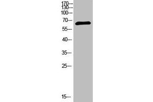Western Blot analysis of 293T cells using primary antibody diluted at 1:1000(4 °C overnight). (NUT (AA 1082-1131) anticorps)