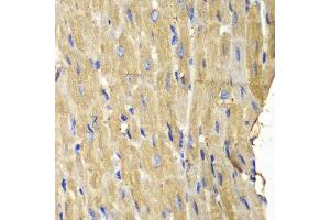 Immunohistochemistry of paraffin-embedded mouse heart using PLCG2 antibody at dilution of 1:100 (400x lens).