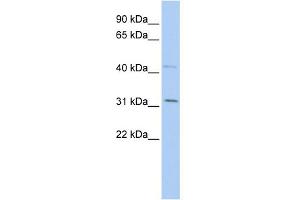 WB Suggested Anti-SIX1 Antibody Titration:  0. (SIX Homeobox 1 anticorps  (Middle Region))