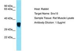 Image no. 1 for anti-Sorting Nexin 15 (SNX15) (C-Term) antibody (ABIN6750523) (SNX15 anticorps  (C-Term))