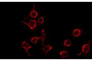 ABIN6274508 staining Hela by IF/ICC. (BLZF1 anticorps  (N-Term))