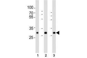 Western blot analysis of lysate from human (1) placenta, (2) lung, (3) kidney tissue lysate using SOD3 antibody at 1:1000.