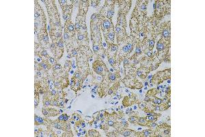 Immunohistochemistry of paraffin-embedded human liver injury using EPO antibody (ABIN5973306) (40x lens). (EPO anticorps)
