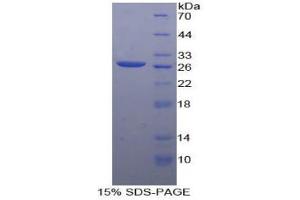 SDS-PAGE analysis of Human PVRL3 Protein. (nectin-3 Protéine)