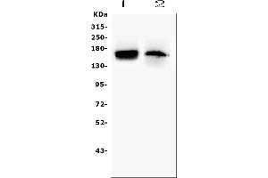 Western blot analysis of TEK using anti-TEK antibody (ABIN7600762). (TEK anticorps  (AA 23-616))