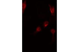 ABIN6267513 staining RAW264. (STAT5 A/B anticorps  (pSer725, pSer730))