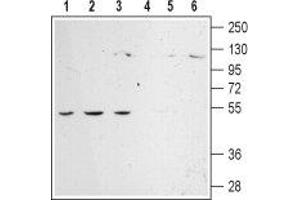 Western blot analysis of rat lung (lanes 1 and 4), kidney (lanes 2 and 5) and brain (lanes 3 and 6) membranes: - 1-3.