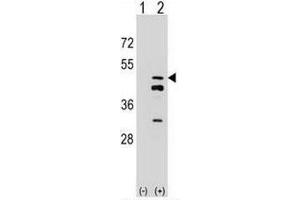 Western blot analysis of FDPS (arrow) using rabbit polyclonal FDPS Antibody (N-term) .