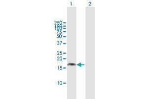 Western Blot analysis of PMAIP1 expression in transfected 293T cell line by PMAIP1 MaxPab polyclonal antibody. (NOXA anticorps  (AA 1-136))