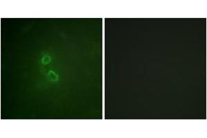 Immunofluorescence analysis of COS7 cells, using CD227/MUC1 (Ab-1229) Antibody. (MUC1 anticorps  (AA 1201-1250))