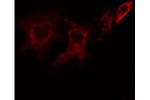 ABIN6266883 staining HeLa cells by IF/ICC. (ITPK1 anticorps  (Internal Region))
