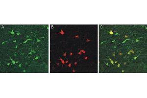 Immunohistochemistry (IHC) image for anti-Calbindin (CALB1) (AA 3-251) antibody (ABIN1742425)