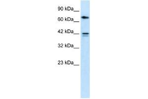 CACNB1 antibody used at 1 ug/ml to detect target protein. (CACNB1 anticorps  (N-Term))