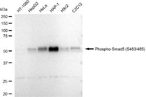 anti-SMAD, Mothers Against DPP Homolog 5 (SMAD5) (pSer463) antibody