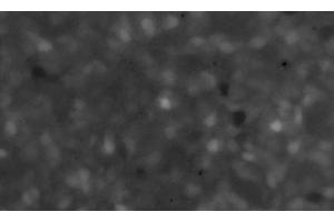 Image of the maximum plot of the fluorescence intensity (F/F0) of a Fluo3-stained culture of SiMa human neuroblastoma cells pretreated for 12 h with 10 μg/ml of α-CJe, and subsequently perfused for 50 s with 10 nmol/l of ACh in standard bath solution. (Campylobacter jejuni anticorps)