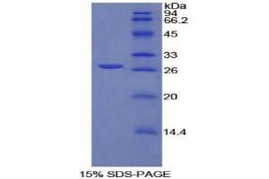 SDS-PAGE analysis of Rat Spondin 2 Protein.